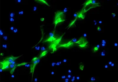 neutrophil extracellular traps NETs coronavirus covid-19 pandemic sars-cov-2 innate immune response immunity pathogen elastase chromatin DNA neutrophil extracellular traps NETs coronavirus covid-19 pandemic sars-cov-2 innate immune response immunity pathogen elastase chromatin DNA